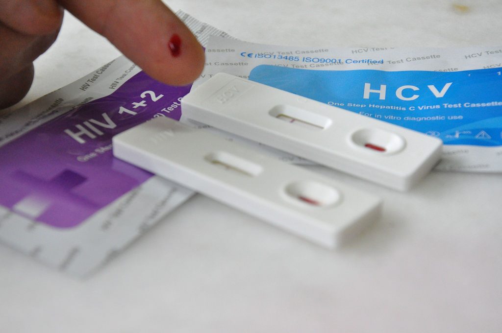 L’1 dicembre test per l’Hiv gratuito in Romagna