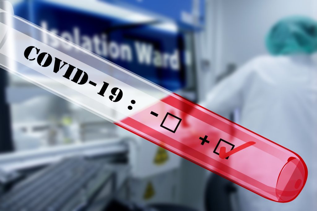 Test rapidi in farmacia, effettuati oltre mezzo milione, il 3% risultato positivo